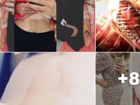 Bu kadın tam 17 yıldır tuvalete gitmiyor! Kadının itirafları sizi şoke edecek!