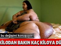 Dünya Bu KADINI Konuşuyor! 500 Kilodan BAKIN Kaç Kiloya Düştü?