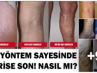 HEMEN VARİSLERİNİZDEN KURTULUN!