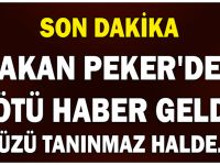 HAKAN PEKER’DEN KÖTÜ HABER GELDİ! YÜZÜ TANINMAZ HALDE