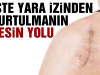 YARA İZİNDEN KURTULMANIN YOLU