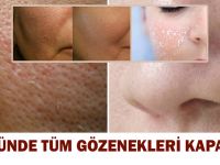 Genişlemiş Gözenekleri Baştan Sona Kapatacak Mucize Maske