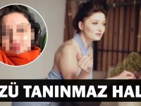 Nurgül Yeşilçay Botoks Kurbanı Oldu! Yüz Olmuş Davul..