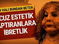 Önce cinsiyet değiştirdi sonra estetik yaptırayım dedi bu hale geldi korkunç son!