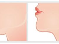 ÇENE ALTINDAKİ GIDIDAN KURTULMAK İSTEYENLERİN EVDE UYGULAMASI GEREKENLER