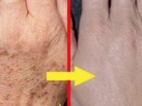 BİRKAÇ GÜNDE TÜM KIRIŞIKLIKLARDAN KURTARAN MASKE