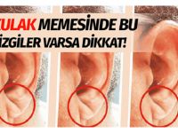 Kulağınızda bu çizgi varmı hemen kontrol edin, eğer varsa tehlike yaklaşıyor