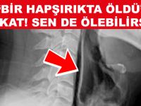 ÇOK ÖNEMLİ BİR BİLGİ! HEPİMİZ "HAPŞIRIYORUZ" BİR HAPŞIRIKTA ONUN GİBİ BİZ DE ÖLEBİLİRSİNİZ NEDEN Mİ