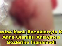 Annesine Kanlı Bacaklarıyla Koştu – Anne Olanları Anlayınca Gözlerine İnanamadı