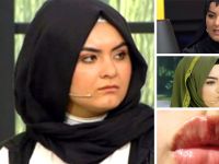 PARAYI BULUNCA BIÇAK ALTINA YATIP ESTETİK YAPTIRDI! ŞİMDİ BAMBAŞKA BİRİ