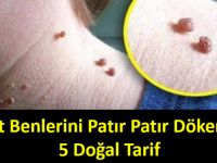 Et Benlerini Patır Patır Döken 5 Doğal Tarif