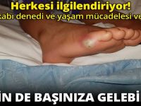 Herkesi ilgilendiriyor! Ayakkabı denedi ve yaşam mücadelesi veriyor!