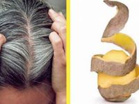 Sadece Patates Kullanarak Beyaz Saçlardan Kurtulabilirsiniz