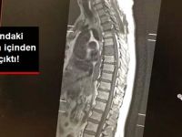 70 Yaşında ki Adamın İçinden Köpek Çıktı…