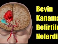 Bir kişinin beyin k-anaması geçirdiğini şu dört basit yöntemle anlayabilirsiniz