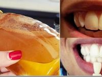 Diş Hekimleri Bunun Bilinmesini İstemiyor, Diş Beyazlatmak İçin En Hızlı Yöntem