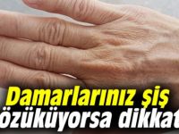 Damarlarınız ş-iş gözü-küyorsa dik-kat!