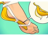 Sıradan 1 Muz Kabuğu İle Üstesinden Gelebileceğiniz 8 Sağlık Problemi