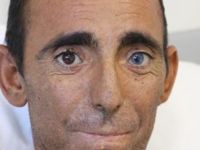 Normalde 2 olması gerekirken onda 5 tane var!