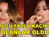 Hadise’nin Dudak Dolgusu Fazla Kaçınca Olanlar Oldu.
