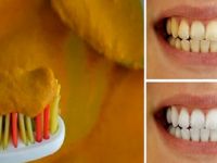 Sarı Durduğuna Bakmayın. 3 Dakikada Dişleri Bembeyaz Yapıyor!