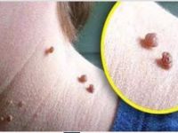 Et Benleri için 5 Doğal Tarif. Patır Patır Dökecek