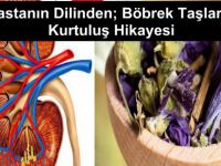 Bir Hastanın Dilinden Böbrek Taşlarından Kurtuluş Hikayesi