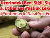 Doğal Yöntemlerle Nasıl Yok Edilir