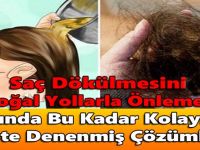 Saç Dökülmesini Doğal Yollarla Önlemek Aslında Bu Kadar Kolaymış İşte Denenmiş Çözümler