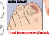 Tırnak batması tedavisi aslında bu kadar basitmiş