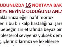 Vücudunuzdaki 16 noktaya bakarak sağlığınız hakkındaki gerçekleri öğrenin!
