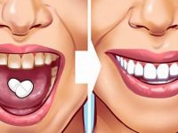 BOZUK DİŞLERİ ESKİ HALİNE GETİRİYOR, 40 YIL DÜŞÜNSENİZ AKLINIZA GELMEZ