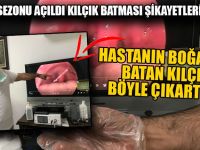 Balık Sezonu Açıldı Kılçık Batması Şikayetleri Arttı
