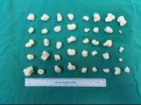 Dizden Çıkan Eklem Fareleri Şaşırttı